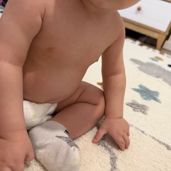 Bebek Kremi Cildinde Şiddetli Alerjik Reaksiyon Ve Güvenlik Talebi