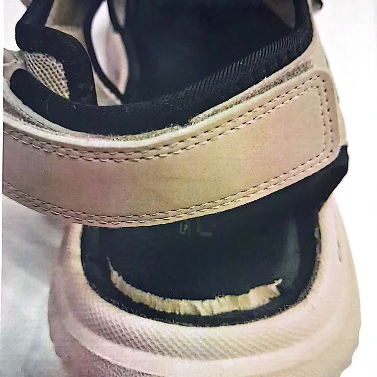 Skechers Sandaleti Üretim Hatası İddiası Ve Mağduriyet