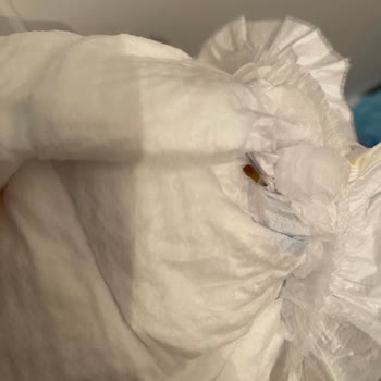Bebek Bezinde Ölmüş Solucan: İade Ve Açıklama Talebi