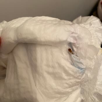 Bebek Bezinde Ölmüş Solucan: İade Ve Açıklama Talebi