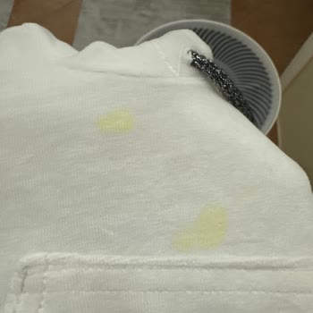 Wee Baby Diş Kaşıyıcısının Patlaması Bebeğin Sağlığını Tehdit Etti