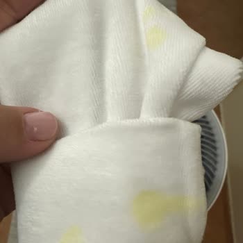 Wee Baby Diş Kaşıyıcısının Patlaması Bebeğin Sağlığını Tehdit Etti