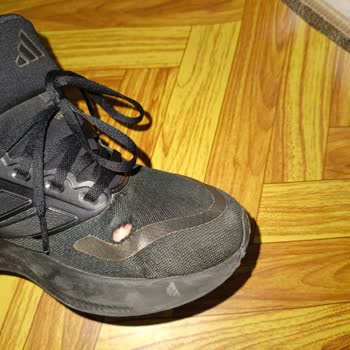 Adidas Ayakkabıda Hızlı Delik Oluşumu Ve Kalite Sorunu