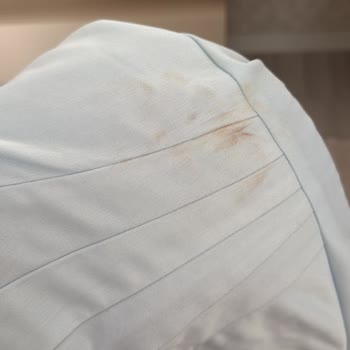 Tesettüre Uygun Olmayan Ve Lekeli Kiralık Elbise, Ölçü Hatası Ve Kötü Müşteri Hizmeti