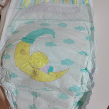 Jenny Willy Bebek Bezinde Yan Bant Kopuklukları Nedeniyle Ürün Değişimi İsteği