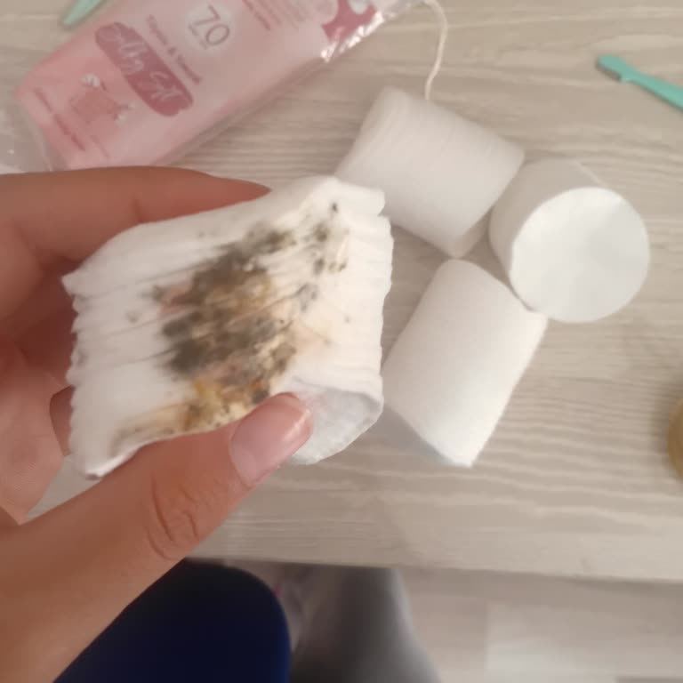Apaks Pamuklarında Küf Lekesi: Hijyen Endişesi Ve Para İadesi
