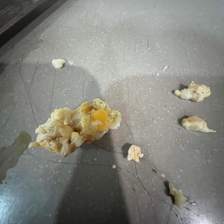 Burger King Siparişinde Kıl Çıktı Hijyen Sorunu Ve İade Talebi
