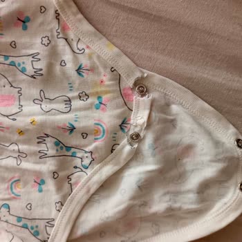 Hello Baby Çıtçıtlı Bebek Kıyafetlerinde Yıkama Sonrası Kalite Sorunu
