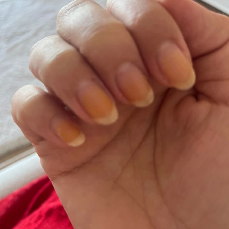 Flormar Kırmızı Ojesi Tırnaklarda Turunculaşmaya Neden Oldu