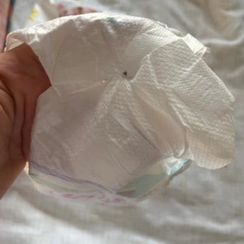 Molfix Ultra Fırsat Paketi Bebek Bezlerinde Kalite Sorunu Ve Telafi Talebi