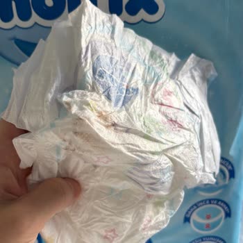 Molfix Ultra Fırsat Paketi Bebek Bezlerinde Kalite Sorunu Ve Telafi Talebi