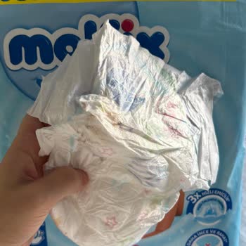 Molfix Ultra Fırsat Paketi Bebek Bezlerinde Kalite Sorunu Ve Telafi Talebi