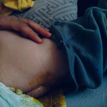 Reklam Edilen %100 Sızdırmazlık Gerçekleşmedi: Bebek Bezinde Sırt Sızıntısı Sorunu