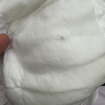 Bebek Bezinde Sert Ve Sivri Yabancı Cisim Tehlikesi