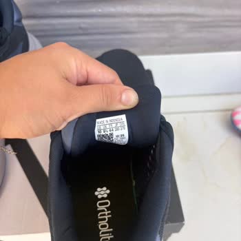 Adidas Ayakkabısında Yanma Sorunu Ve Haksız Reddedilme