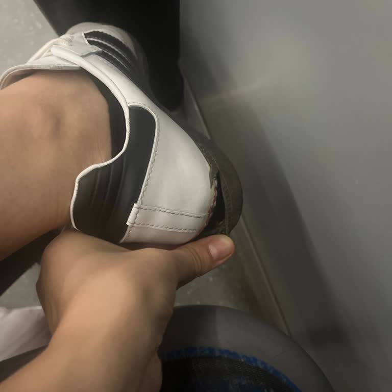 Instagram'dan Satın Alınan Adidas Samba Ayakkabısının Orijinalliği Şüpheli, Tabanı Çatladı