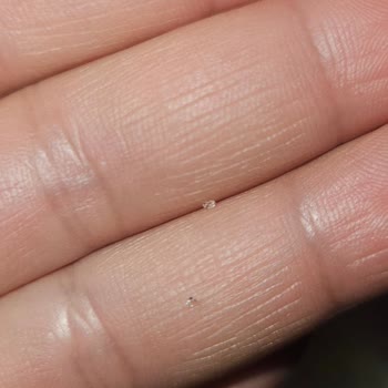 Molfix 5 Numara Bezinde Tanecik Sorunu Ve Bebekte Pişik Oluştu
