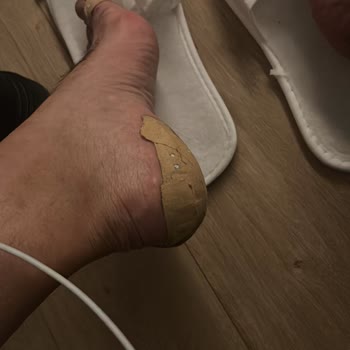 Derimod Botunda Ayak Yaralarına Neden Olması Ve İade Talebi