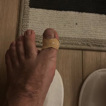Derimod Botunda Ayak Yaralarına Neden Olması Ve İade Talebi