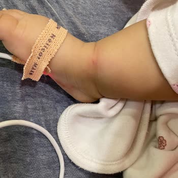 Bebekte Deneyimsiz Personelin Defalarca İğne Denemesi