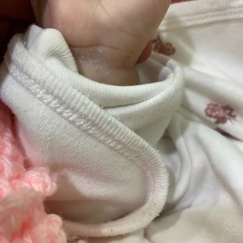 Bebekte Deneyimsiz Personelin Defalarca İğne Denemesi