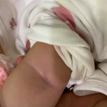 Bebekte Deneyimsiz Personelin Defalarca İğne Denemesi
