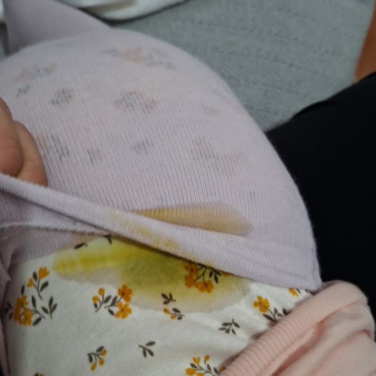 Molfix 4 Numaralı Bebek Bezinde Sürekli Sızıntı Şikayeti