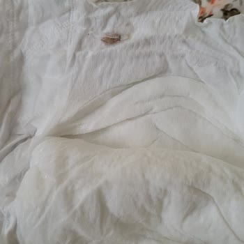 Baby Turco Bebek Bezinde Kurt Bulunduğu İçin Sağlık Endişesi