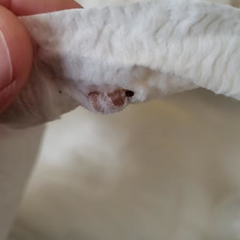 Baby Turco Bebek Bezinde Kurt Bulunduğu İçin Sağlık Endişesi