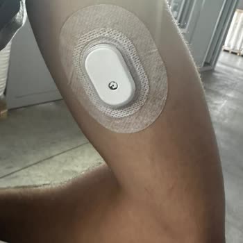 Ağrı Ve Yanlış Ölçüm Nedeniyle GS1 Glikoz Sensörünün Değişimini Talep Ediyorum