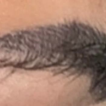 Yanlış Kaş İşlemi Ve 19.800 TL İade Reddi