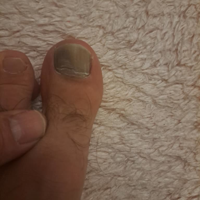 Sağlığıma Zarar Veren Ayakkabı İadesi Reddedildi, Açıklama Ve Tam İade İstiyorum