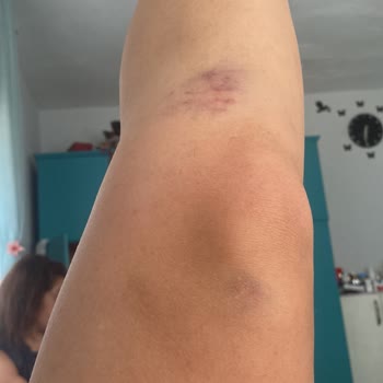 Ceyhan Belediyesi Çamlıyol’da Tehlikeli Çukur Ve Uyarı Eksikliği