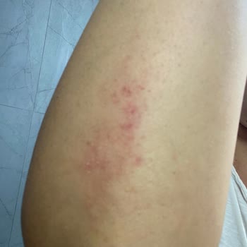 Ceyhan Belediyesi Çamlıyol’da Tehlikeli Çukur Ve Uyarı Eksikliği