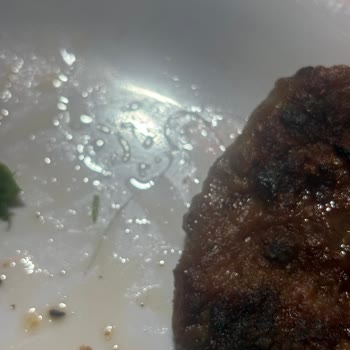 Köfteci Yusuf Şubesinde Kıl Tespiti Ve Hijyen Endişesi
