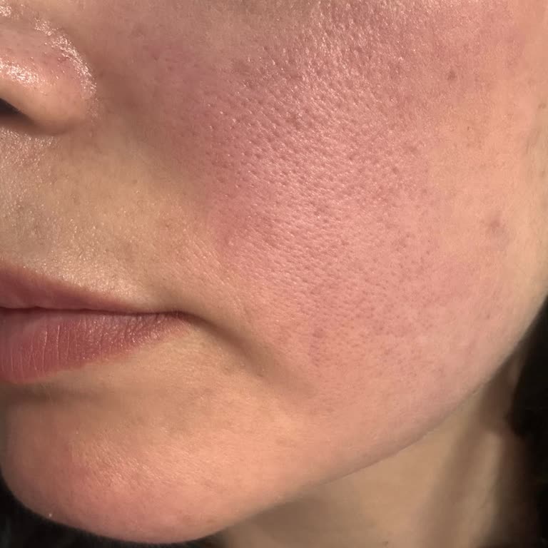 Estee Lauder Setinde Cilt Tahrişi Ve İade Talebi