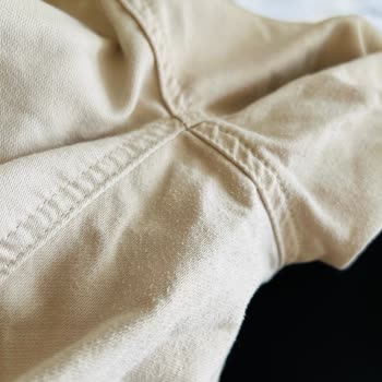 2-3 Kez Giyilen Pantolon Tüylenmeye Başladı, Mağaza Kullanıcı Hatası Dedi
