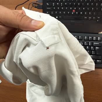 Lufian’da Dikiş Hatalı Ürünler Kullanıcı Hatası Gibi Reddedildi