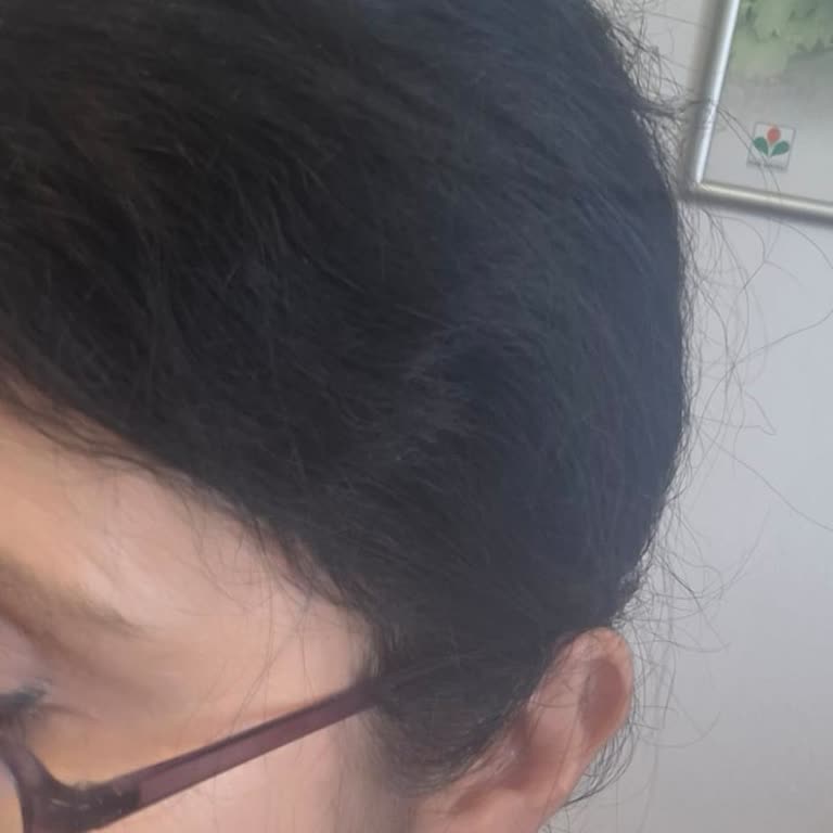 Olaplex Ürünleri Saç Kaybı Ve Kuruma Nedeniyle Tam İade Ve İnceleme Talebi