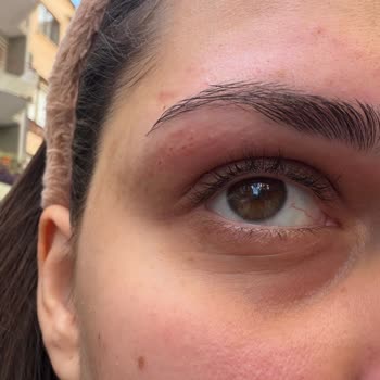 Kaş alma hizmetinde yaşanan sorun ve iade talebi