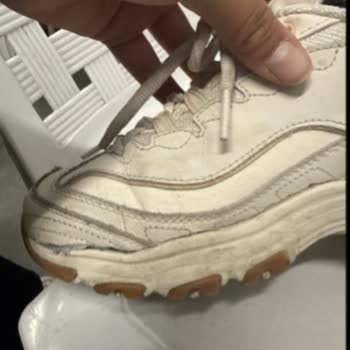 Skechers Ayakkabısında Sağ Ayakta Yırtılma Ve Müşteri Hizmetlerinin Cevap Vermemesi