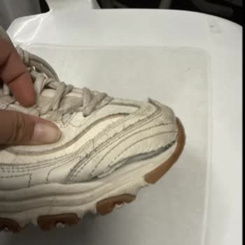 Skechers Ayakkabısında Sağ Ayakta Yırtılma Ve Müşteri Hizmetlerinin Cevap Vermemesi