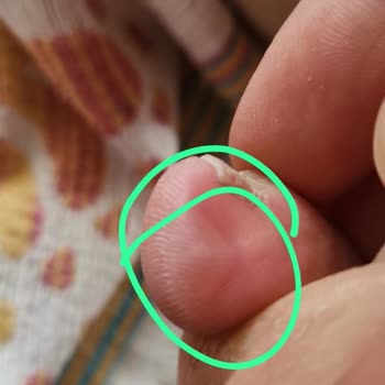 Ayaklarımda Şiddetli Yaralar Bırakan Tamer Tanca Ayakkabısı İçin İade