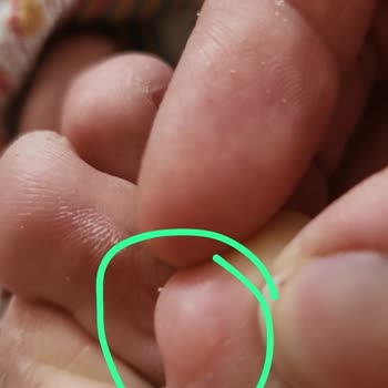 Ayaklarımda Şiddetli Yaralar Bırakan Tamer Tanca Ayakkabısı İçin İade