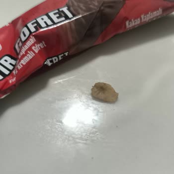 Torku Gofretten Gelen Gizemli Sert Cisim Ağız Sağlığını Tehlikeye Atıyor