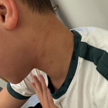Okulda Şiddetli Kavga Sonucu Boyun Morluğu Ve Güvenlik Önlemlerinin Yetersizliği