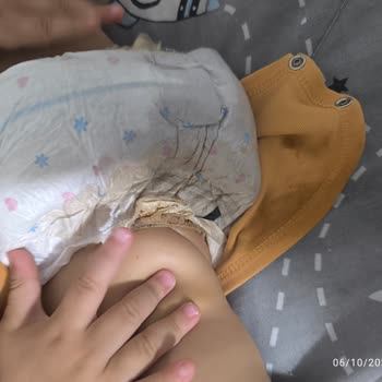 Minies 5 Junior Bebek Bezi Sızdırıyor Ve Hijyen Endişesi Yaratıyor