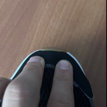 Skechers Mağazası Deforme Ayakkabıya Misliyle Değişim İsteği Reddedildi