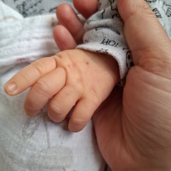 Bebek Kan Analiz Sonuçlarının Sisteme Girmemesi Ve Bilgilendirme Eksikliği