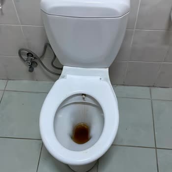 Kirli Tuvalet Ve Duşlar, Hijyen İhmali Hastaları Enfeksiyon Riskine Maruz Bırakıyor